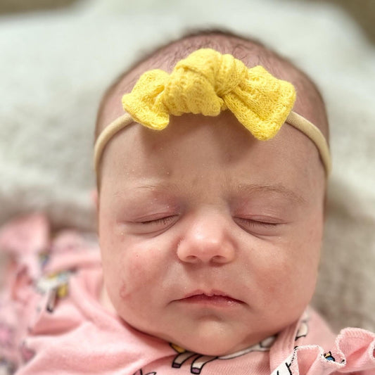 Yellow Bree Bow